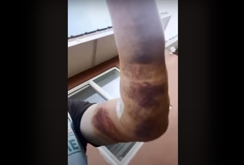 Donald Cerrone mostra a lesão no bíceps ao montar touro de Dana White — Foto: Reprodução / Youtube