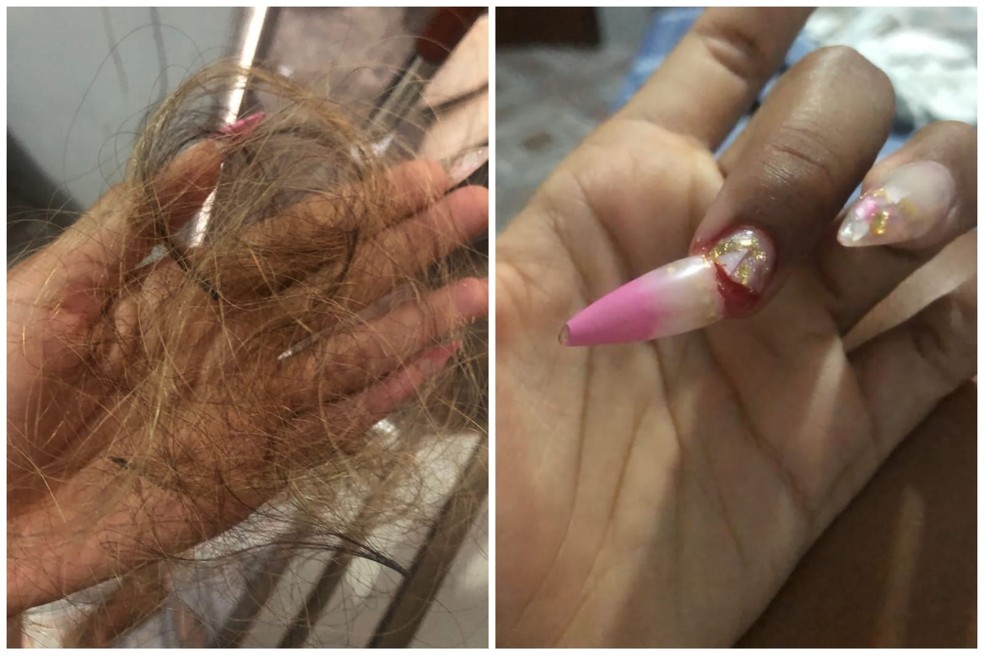 Jovem mostra ferimentos da agressão sofrida — Foto: Redes sociais