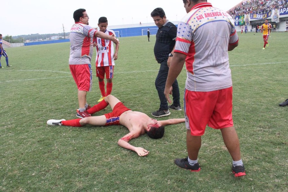 No futebol português, os jogadores vão para o chão demasiadas