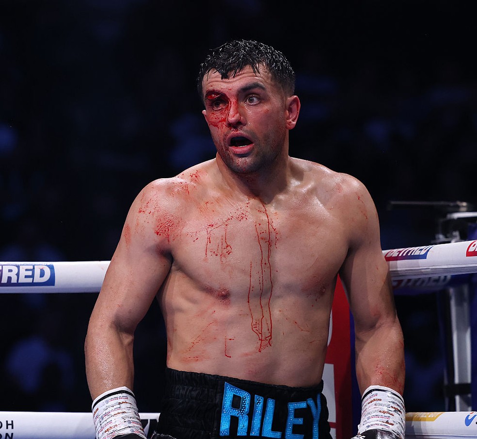 Jack Catterall venceu Harlem Eubank &mdash; Foto: Mark Robinson/Matchroom Boxing/Getty Images