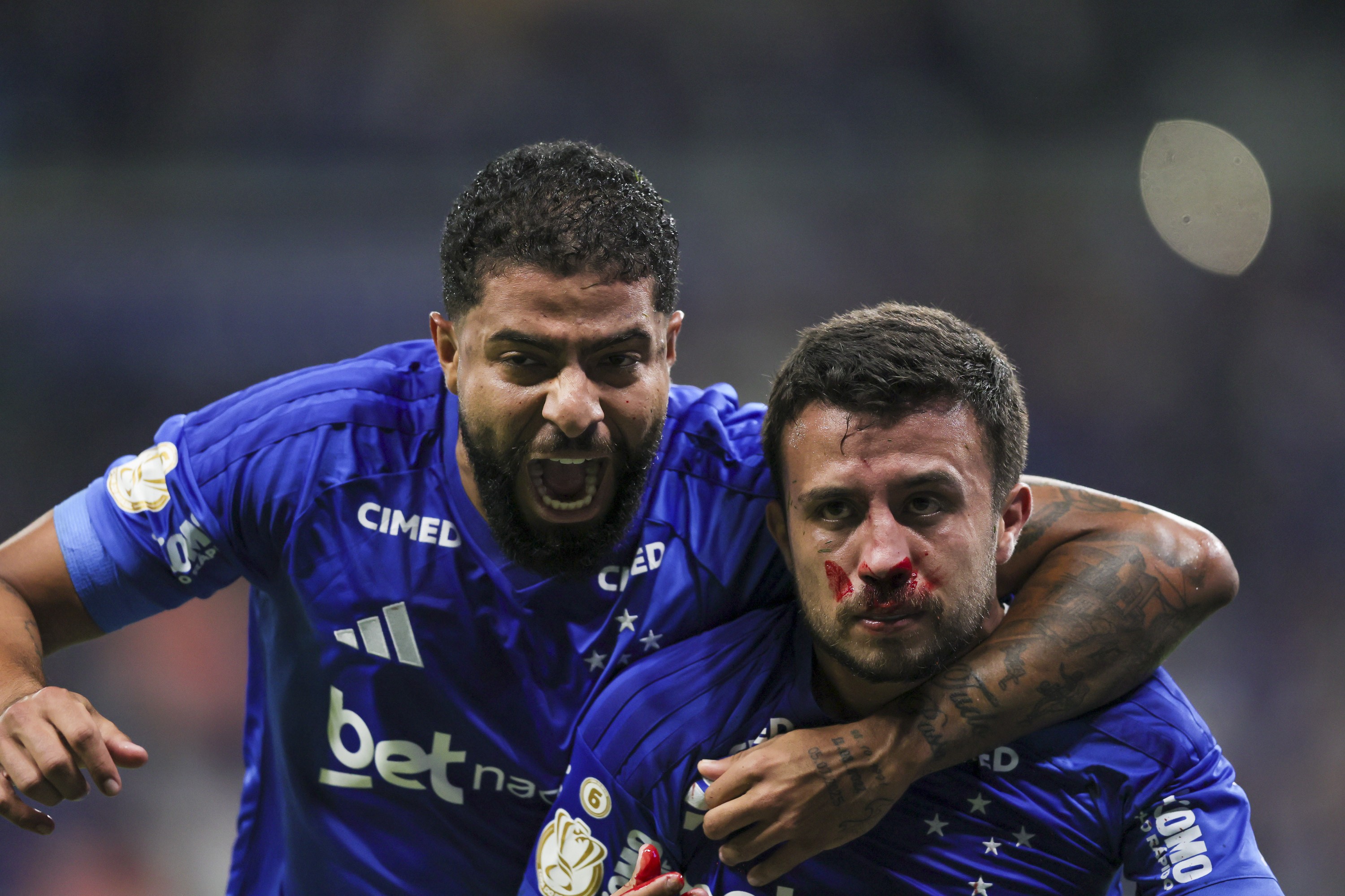 Dúvida contra o Flamengo? Matheus Henrique explica situação após fraturar nariz em jogo do Cruzeiro