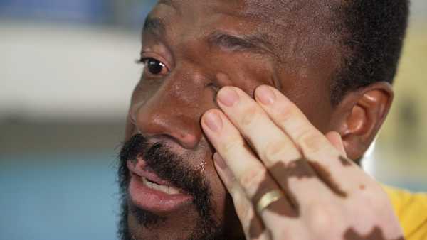 Ex-atleta do NBB desabafa sobre preconceito após se maquiar para esconder vitiligo: